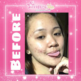 DERMAX - Brightest Skin Essentials Rejuvenating Derma Set