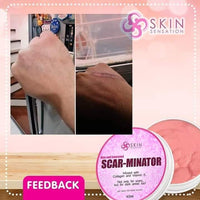Scar-minator Cream