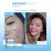 Sevendays Exfoliating Facial Set by Her Skin - Extra Strength Rejuv Facial Set - Herskin