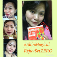 Skin Magical Cassie Rejuvenating Set Zero for Sensitive Skin