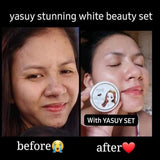 Yasuy Beauty Set - Rejuvenating Set ( New Packaging)