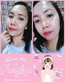 FairySkin Derma Facial Set (New Packaging)